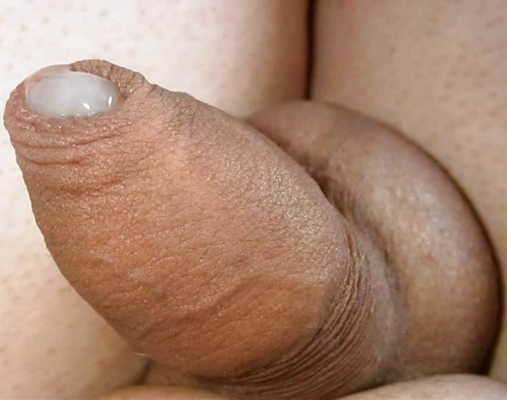 Shaved penis itchy