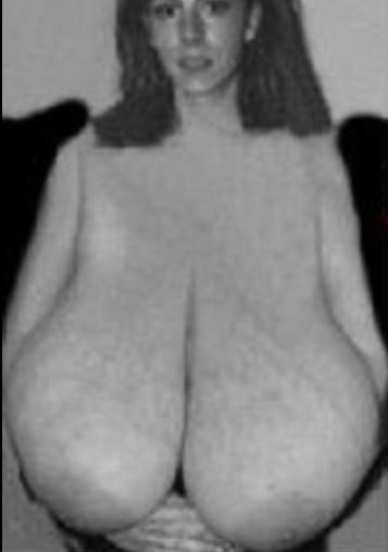 Sixe Macromastia Tits Massive - Porn Sex Photos
