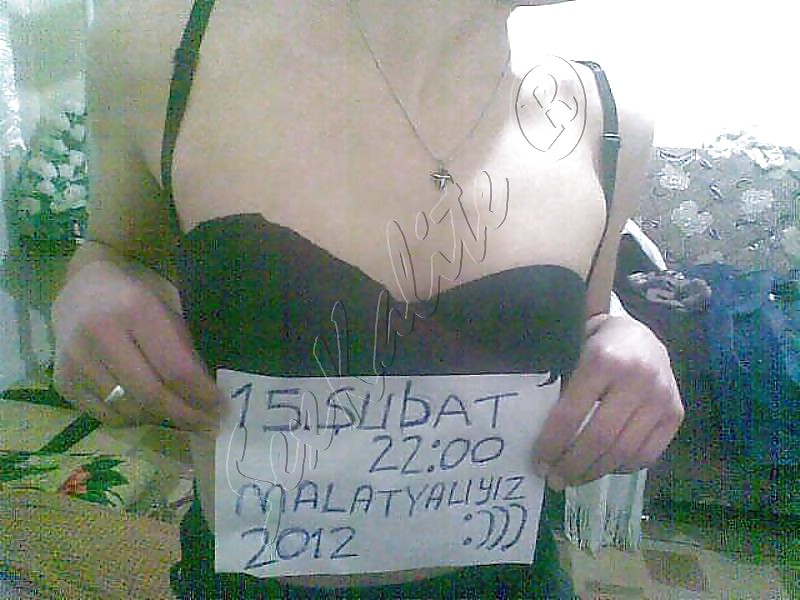 Sex Gallery malatyali cift