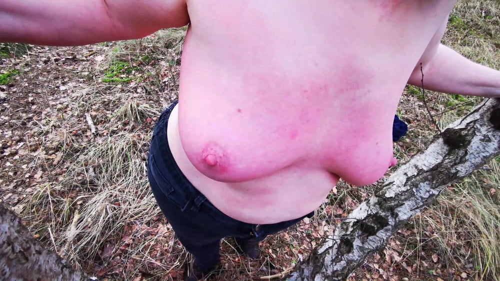 Titslapping in woods - 14 Photos 