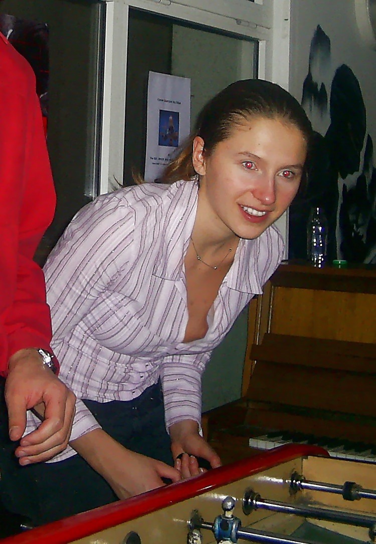 Sex Gallery Amateur Nippel  Blitzer 2