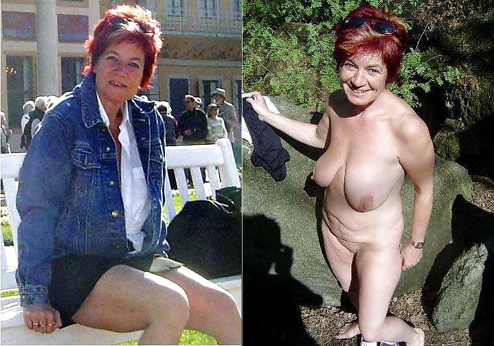 Sex Gallery Before After 95.