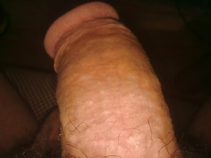 Sex Gallery my cock... penisim