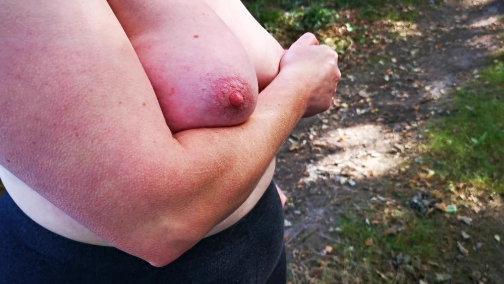 Tit Slapping Red For Fun While Hiking