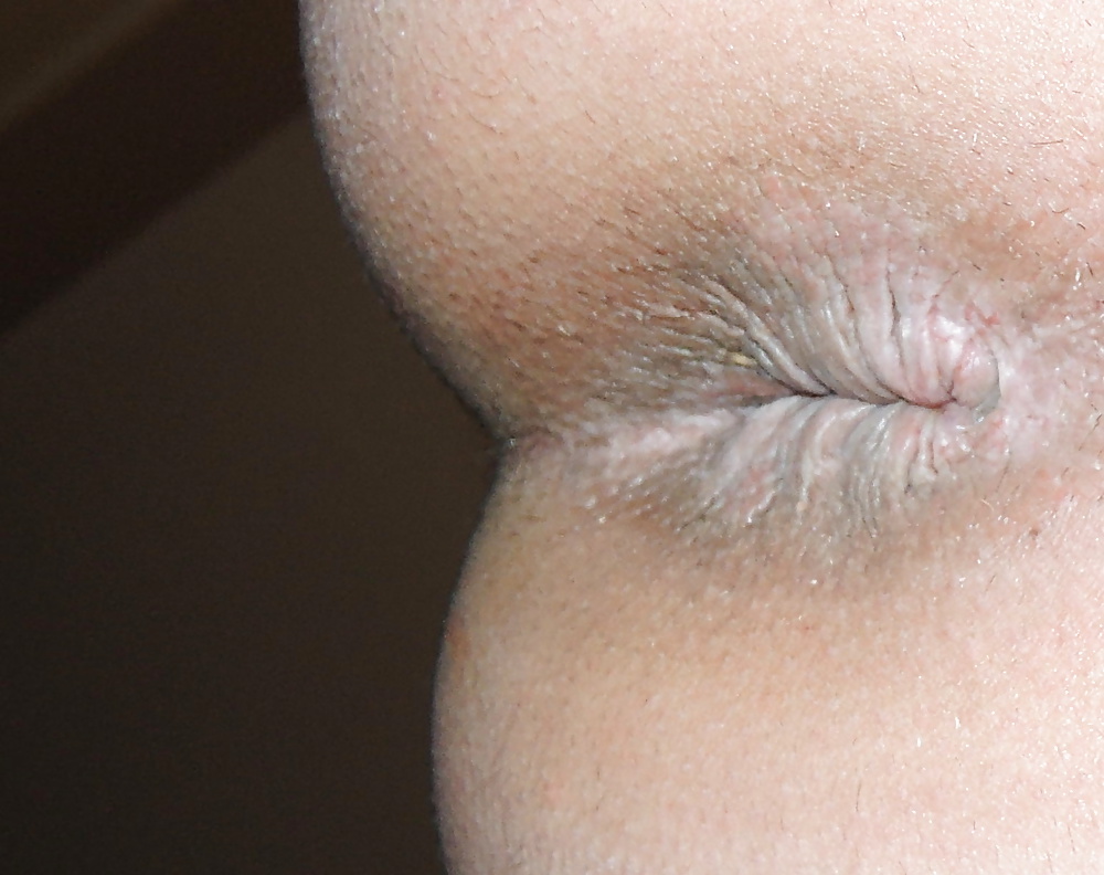 Sex Gallery Mixed pics of my butthole from 18 until now