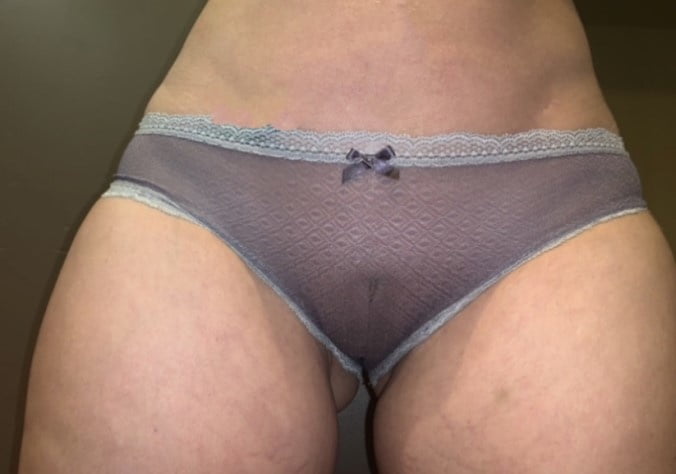 Matures in lingerie front and back 3 - 50 Pics 