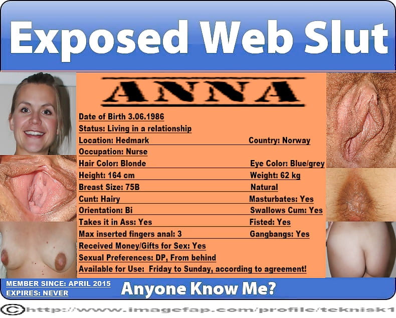Sex Gallery ANNA Norway