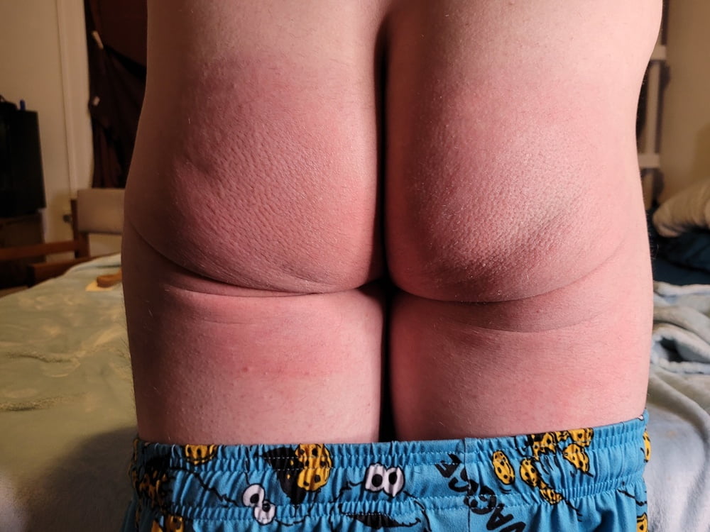 Spanked Butts - 12 Photos 