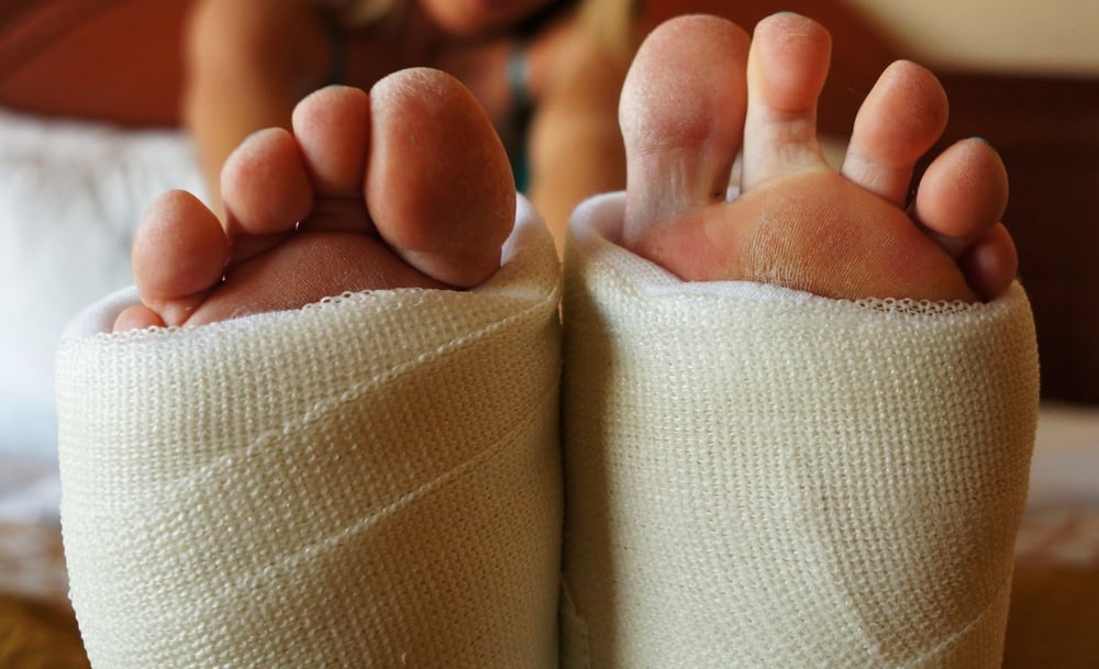Toes in Casts (Webfinds) - 13 Photos 