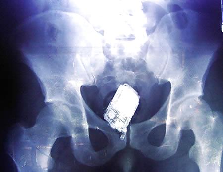 Sex Gallery x-ray
