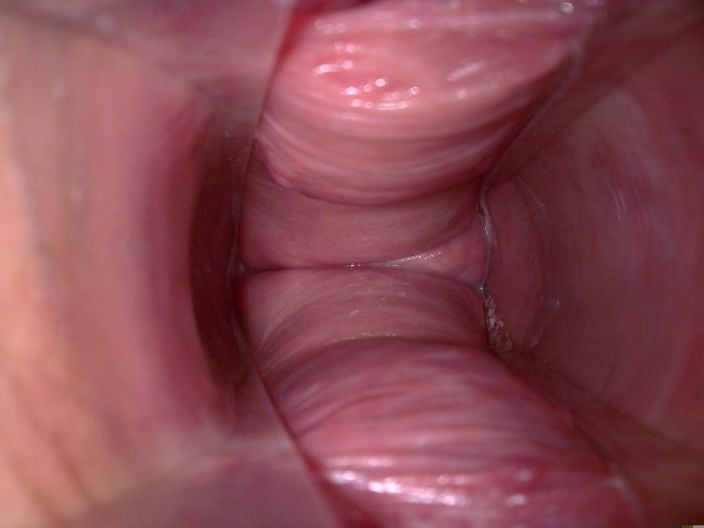 What does the inside of a vagina look like