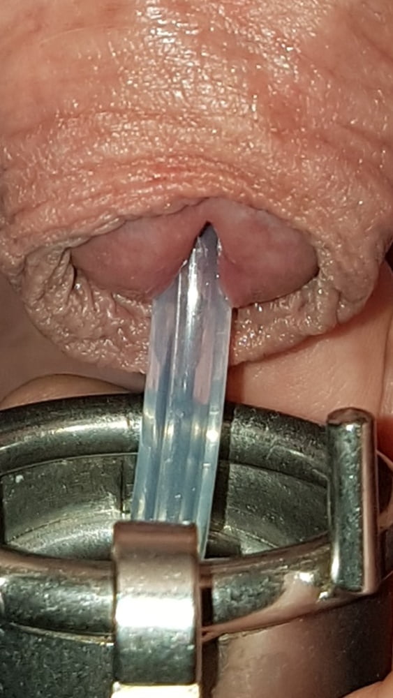 Urethral Insertion 80 Pics 2 Xhamster