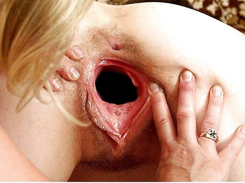 deshevie-putani-foto-pizdi-krupnim-planom-s-dirkoy-lesbiyanok-onlayn-seks