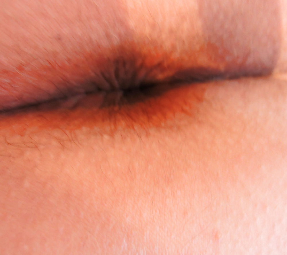 Sex Gallery My teen butthole last night